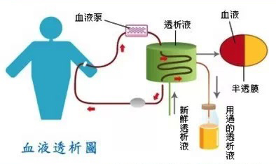 糖尿病的人透析是什么原理_什么是糖尿病图片